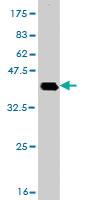 Anti-DHX8 Mouse Monoclonal Antibody [clone: 1E10]