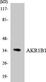 Western blot analysis of the lysates from HUVEC cells using Anti-AKR1B1 Antibody