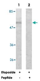 Anti-AKT1 Rabbit Polyclonal Antibody