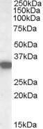 Anti-HADH Antibody (A84434) (0.02 µg/ml) staining of Human Kidney lysate (35 µg protein in RIPA buffer). Primary incubation was 1 hour. Detected by chemiluminescence