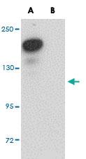 Anti-PLEKHM2 Rabbit Polyclonal Antibody