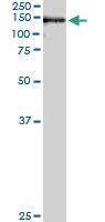 Anti-USP33 Mouse Monoclonal Antibody [clone: 5B5]