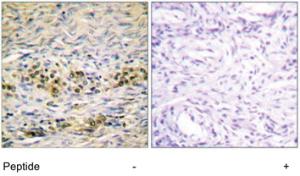 Anti-AKT1 Rabbit Polyclonal Antibody