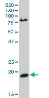 Anti-HRASLS Mouse Polyclonal Antibody