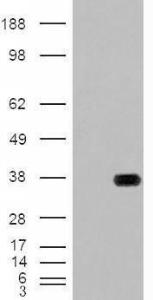 HEK293 overexpressing HADH (RC201752) with C-terminal tag (DYKDDDDK) and probed with anti-DYKDDDDK in the left panel and with Anti-HADH Antibody (A84434) in the right panel (mock transfection in first and last lanes), tested by Origene