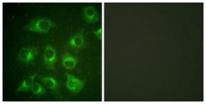 Immunofluorescence analysis of HUVEC cells using Anti-CrkII Antibody. The right hand panel represents a negative control, where the antibody was pre-incubated with the immunising peptide