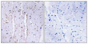 Immunohistochemical analysis of paraffin-embedded human heart tissue using Anti-AKAP13 Antibody. The right hand panel represents a negative control, where the antibody was pre-incubated with the immunising peptide