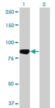 Anti-MARK3 Mouse Monoclonal Antibody [clone: 1A10]