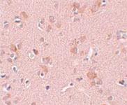 Anti-PLEKHM3 Rabbit Polyclonal Antibody