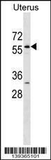 Anti-LEMD2 Rabbit Polyclonal Antibody (FITC (Fluorescein Isothiocyanate))