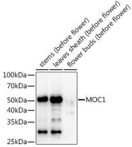 Western blot analysis of extracts of various tissues from the japonica rice (Oryza sativa L. ) variety Zhonghua 11, using Anti-MOC1 Antibody (A309989) at 1:1,000 dilution. The secondary antibody was Goat Anti-Rabbit IgG H&L Antibody (HRP) at 1:10,000 dilution.