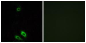 Anti-AKR1CL1 antibody