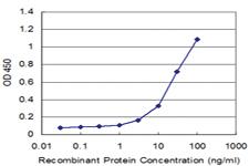 Anti-MARK3 Mouse Monoclonal Antibody [clone: 1A10]