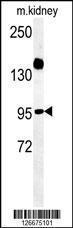 Anti-ARMC5 Rabbit Polyclonal Antibody (AP (Alkaline Phosphatase))