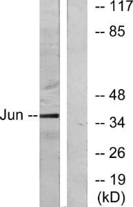 Western blot analysis of lysates from HeLa cells using Anti-c-Jun Antibody. The right hand lane represents a negative control, where the antibody is blocked by the immunising peptide