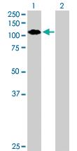 Anti-ZNF408 Mouse Polyclonal Antibody