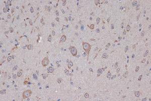 Immunohistochemistry analysis of paraffin-embedded mouse brain using Anti-Xanthine Oxidase Antibody [ARC1385] (A308953) at a dilution of 1:100 (40X lens). Perform microwave antigen retrieval with 10 mM Tris/EDTA buffer pH 9.0 before commencing with IHC staining protocol