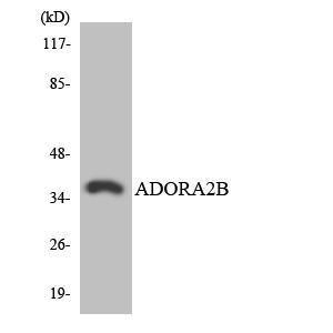 Western blot analysis of the lysates from HT 29 cells using Anti-ADORA2B Antibody