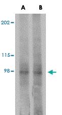 Anti-PLEKHM3 Rabbit Polyclonal Antibody