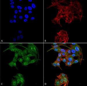 Immunocytochemistry/Immunofluorescence analysis of human colon carcinoma cell line (RKO), fixed in 4% formaldehyde for 15 min at room temperature, using Anti-ATG4D Antibody (A304858), at 1:100 for 60 minutes at room temperatur