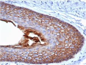 Immunohistochemical analysis of formalin-fixed, paraffin-embedded human skin using Anti-E Cadherin Antibody [CDH1/4585]