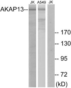 Western blot analysis of lysates from Jurkat and A549 cells using Anti-AKAP13 Antibody. The right hand lane represents a negative control, where the antibody is blocked by the immunising peptide