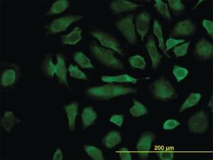 Anti-CFLAR Mouse Monoclonal Antibody [clone: 2F12]