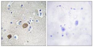 Immunohistochemical analysis of paraffin-embedded human brain tissue using Anti-Catenin-alpha1 Antibody. The right hand panel represents a negative control, where the Antibody was pre-incubated with the immunising peptide