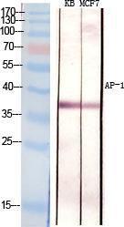 Immunohistochemical analysis of paraffin-embedded human Appendix tissue using Anti-c-Jun Antibody at 1:200 (4°C overnight). Negative control was secondary antibody only