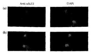 Anti-Sds22 Antibody