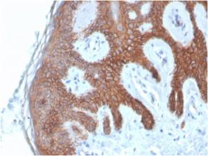 Immunohistochemical analysis of formalin-fixed, paraffin-embedded human skin using Anti-E Cadherin Antibody [CDH1/4585]