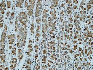 Immunohistochemical analysis of paraffin-embedded human stomach using Anti-Catenin-alpha1 Antibody