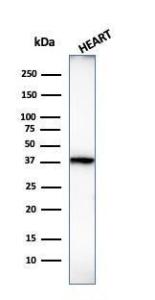 Western blot analysis of human heart tissue lysate using Anti-Histone H1 Antibody [1415-1]