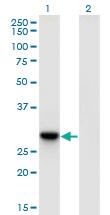 Anti-DNAJC27 Mouse Monoclonal Antibody [clone: 3C1]