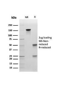 SDS-PAGE analysis of Anti-E Cadherin Antibody [CDH1/4585] under non-reduced and reduced conditions; showing intact IgG and intact heavy and light chains, respectively. SDS-PAGE analysis confirms the integrity and purity of the antibody.