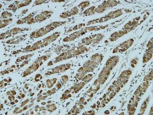 Immunohistochemical analysis of paraffin-embedded human stomach using Anti-Catenin-alpha1 Antibody