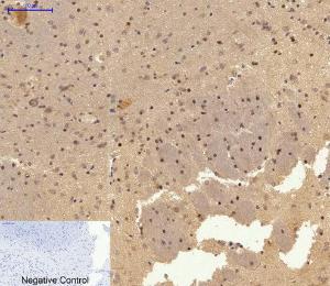 Immunofluorescence analysis of rat lung tissue using Anti-c-Jun Antibody (red) at 1:200 (4°C overnight). Cy3 labelled secondary antibody was used at 1:300 (RT 50min). Panel A: Target. Panel B: DAPI. Panel C: Merge