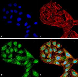 Immunocytochemistry/Immunofluorescence analysis of human cervical cancer cell line (HeLa), fixed in 4% formaldehyde for 15 min at room temperature, using Anti-WIPI2 Antibody (A304859), at 1:100 for 60 minutes at room temperature