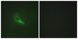 Immunofluorescence analysis of HeLa cells using Anti-AKAP12 Antibody. The right hand panel represents a negative control, where the antibody was pre-incubated with the immunising peptide.