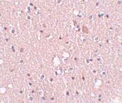 Anti-SIPA1L2 Rabbit Polyclonal Antibody