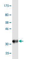 Anti-DHX9 Mouse Monoclonal Antibody [clone: 1D10]