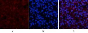 Immunofluorescence analysis of human lung tissue using Anti-c-Jun Antibody (red) at 1:200 (4°C overnight). Cy3 labelled secondary antibody was used at 1:300 (RT 50min). Panel A: Target. Panel B: DAPI. Panel C: Merge