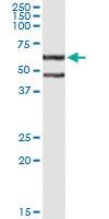 Anti-CFLAR Mouse Monoclonal Antibody [clone: 1G1]