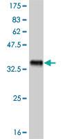 Anti-FRZB Mouse Monoclonal Antibody [clone: 3C3]