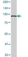 Anti-MARS Mouse Polyclonal Antibody