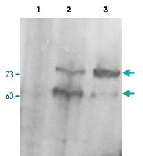 Anti-PCSK9 Goat Polyclonal Antibody