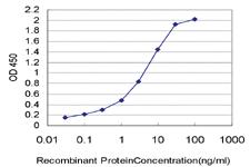 Anti-THUMPD1 Mouse Monoclonal Antibody [clone: 4A11]