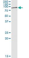 Anti-RIOK2 Polyclonal Antibody Pair