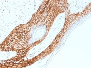 Immunohistochemical analysis of formalin-fixed, paraffin-embedded human skin using Anti-E Cadherin Antibody [4A2]