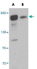 Anti-SIPA1L2 Rabbit Polyclonal Antibody